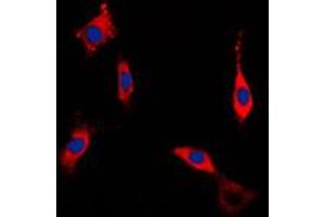 Immunofluorescent analysis of ROCK1 staining in NIH3T3 cells. (ROCK1 anticorps  (Center))