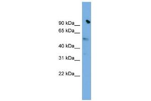 WB Suggested Anti-SLC25A25 Antibody Titration:  0. (SLC25A25 anticorps  (N-Term))