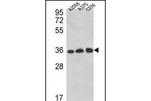 Western blot analysis of GDH Antibody (C-term ) 7873b in , , CEM cell line lysates (35 μg/lane). (GAPDH anticorps  (C-Term))