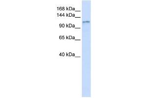 DGKH antibody used at 1 ug/ml to detect target protein. (DGKH anticorps  (Middle Region))