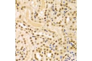 Immunohistochemistry of paraffin-embedded mouse kidney using DKC1 Antibody (ABIN5970956) at dilution of 1/100 (40x lens). (DKC1 anticorps)