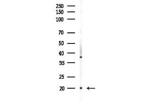 anti-Chromosome 19 Open Reading Frame 10 (C19orf10) antibody