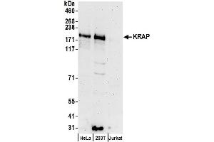 Western Blotting (WB) image for anti-Sperm Specific Antigen 2 (SSFA2) (AA 1209-1259) antibody (ABIN7450400)