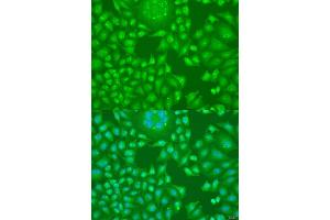 Immunofluorescence analysis of U2OS cells using CCND2 antibody (ABIN1875413) at dilution of 1:100. (Cyclin D2 anticorps)