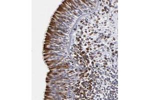 Immunohistochemical staining of human nasopharynx with CEP97 polyclonal antibody  shows strong cytoplasmic positivity in respiratory epithelial cells at 1:200-1:500 dilution. (CEP97 anticorps)