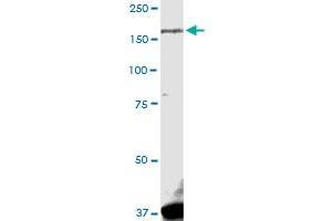 LRRK1 MaxPab rabbit polyclonal antibody. (LRRK1 anticorps  (AA 1-261))