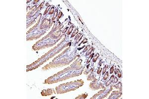 IHC analysis of EIF4A using anti-EIF4A antibody (ABIN7601309). (EIF4A1 anticorps  (AA 32-406))