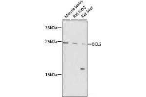 Western blot analysis of extracts of various cells using Bcl-2 Polyclonal Antibody at dilution of 1:1000. (Bcl-2 anticorps)