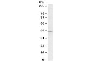 Western blot testing of HeLa lysate with ARPC1A antibody at 0. (ARPC1A anticorps)