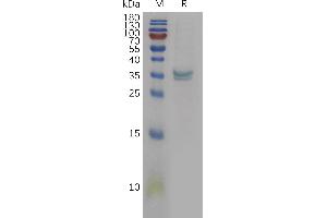 Human Protein, His Tag on SDS-PAGE under reducing condition.