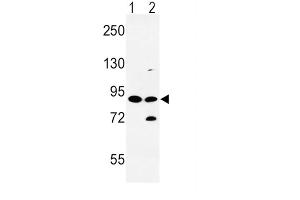 Western Blotting (WB) image for anti-Solute Carrier Family 8 (Sodium/calcium Exchanger), Member 1 (SLC8A1) antibody (ABIN3003974) (SLC8A1 anticorps)