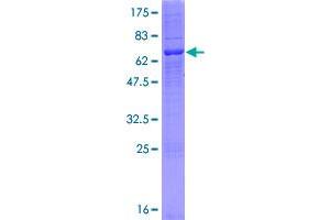 Image no. 1 for Abhydrolase Domain Containing 6 (ABHD6) (AA 1-337) protein (GST tag) (ABIN1305524)