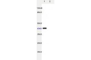 L1rat brain, L2 rat hreat lysates probed (ABIN725555) at 1:200 in 4 °C.