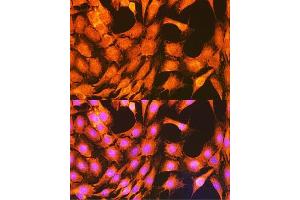 Immunofluorescence analysis of C6 cells using PHKG2 Rabbit pAb  at dilution of 1:100 (40x lens).