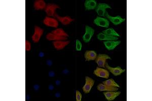 Phospho-IREB1 (Ser711) Antibody staining Hela cells(heat shock treatment) by IF/ICC. (Aconitase 1 anticorps  (pSer711))