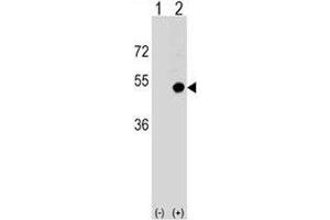 Western blot analysis of CD1d antibody and 293 cell lysate (2 ug/lane) either nontransfected (Lane 1) or transiently transfected (2) with the CD1D gene.
