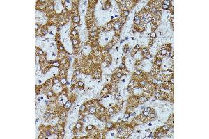 Immunohistochemistry of paraffin-embedded human liver using Apolipoprotein C3 antibody (ABIN7265641) at dilution of 1:100 (40x lens).