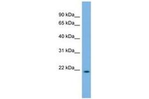 Image no. 1 for anti-DCMP Deaminase (DCTD) (C-Term) antibody (ABIN6743596) (DCMP Deaminase (DCTD) (C-Term) anticorps)