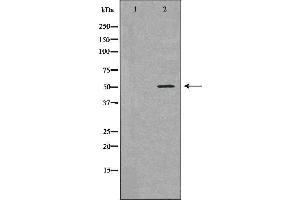 Western blot analysis of Jurkat  lysate using BCL2L13 antibody. (BCL2L13 anticorps  (Internal Region))