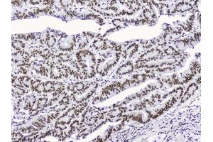 IHC analysis of nmt55/p54nrb using anti-nmt55/p54nrb antibody (ABIN3044530).