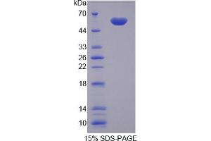 SDS-PAGE of Protein Standard from the Kit (Highly purified E. (NAMPT Kit ELISA)