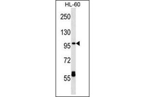 Western blot analysis of CPT1C Antibody (C-term) Cat. (CPT1C anticorps  (C-Term))
