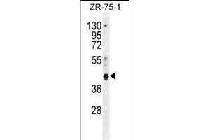 PYGO1 Antibody (C-term) (ABIN656121 and ABIN2845460) western blot analysis in ZR-75-1 cell line lysates (35 μg/lane). (PYGO1 anticorps  (C-Term))