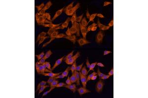 Immunofluorescence analysis of PC-12 cells using CLIC1 Rabbit pAb (ABIN6128983, ABIN6138719, ABIN6138721 and ABIN6217770) at dilution of 1:150 (40x lens).