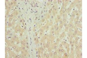 Immunohistochemistry of paraffin-embedded human liver tissue using ABIN7149150 at dilution of 1:100