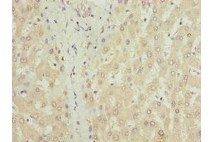 Immunohistochemistry of paraffin-embedded human liver tissue using ABIN7149150 at dilution of 1:100 (COX17 anticorps  (AA 1-63))