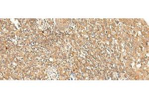 Immunohistochemistry of paraffin-embedded Human tonsil tissue using GPR89A/GPR89B Polyclonal Antibody at dilution of 1:25(x200)