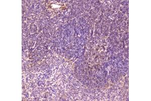 IHC testing of FFPE mouse spleen tissue with CD163 antibody at 1ug/ml. (CD163 anticorps)