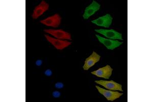 CaMKII alpha Mouse Monoclonal Antibody staining Hela cells by IF/ICC. (CAMK2A anticorps)