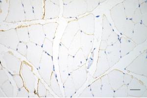 Immunohistochemistry was performed on paraffin-embedded mouse skeletal muscle using caveolin 3 antibody (ABIN7797947), 1:200). (Recombinant Caveolin 3 anticorps)