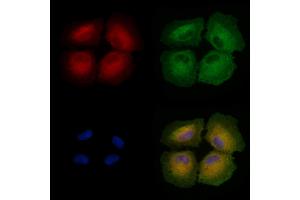 ABIN6258498 and ABIN6274470 staining  cells by IF/ICC. (ORCTL-2/SLC22A18 anticorps  (C-Term))