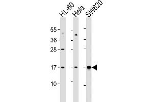 All lanes : Anti-UBE2N Antibody (Center) at 1:1000 dilution Lane 1: HL-60 whole cell lysates Lane 2: Hela whole cell lysates Lane 3: S whole cell lysates Lysates/proteins at 20 μg per lane. (UBE2N anticorps  (AA 41-74))
