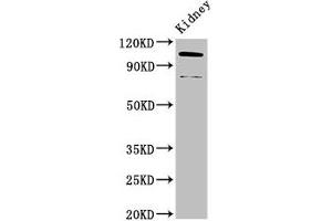 Western Blot Positive WB detected in: Mouse kidney tissue All lanes: ACTN4 antibody at 3.