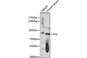 Western blot analysis of extracts of various cell lines, using EPX antibody (ABIN7266966) at 1:1000 dilution. (EPX anticorps  (AA 400-500))