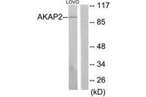 Western Blotting (WB) image for anti-A Kinase (PRKA) Anchor Protein 2 (AKAP2) (AA 71-120) antibody (ABIN2889820) (AKAP2 anticorps  (AA 71-120))