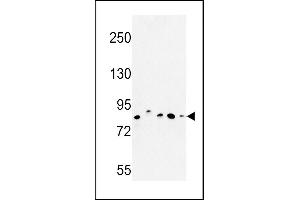 Western blot analysis of CHPF Antibody (Center) (ABIN652988 and ABIN2842628) in MDA-M, MCF-7, HepG2,  cell line and mouse testis tissue lysates (35 μg/lane).