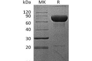 Western Blotting (WB) image for Programmed Cell Death 1 Ligand 2 (PDCD1LG2) protein (Fc Tag) (ABIN7320964)