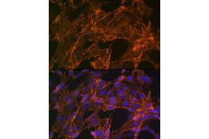 Immunofluorescence analysis of NIH-3T3 cells using α-Actinin-4 Rabbit mAb (ABIN7265399) at dilution of 1:100 (40x lens). (alpha Actinin 4 anticorps)