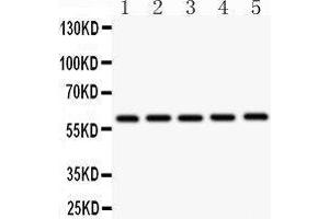 Western Blotting (WB) image for anti-Cystathionine-beta-Synthase (CBS) (AA 331-551) antibody (ABIN3043747)