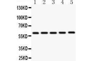 Western Blotting (WB) image for anti-Cystathionine-beta-Synthase (CBS) (AA 331-551) antibody (ABIN3043747) (CBS anticorps  (AA 331-551))