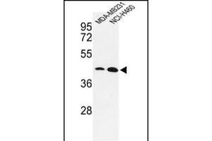 Western blot analysis of KLF4- f in MDA-M, NCI- cell line lysates (35 μg/lane). (KLF4 anticorps  (AA 481-504))