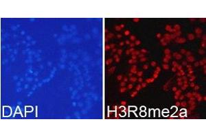 Immunofluorescence analysis of 293T cell using H3R8me2a antibody. (Histone anticorps)