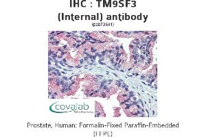 anti-Transmembrane 9 Superfamily Member 3 (TM9SF3) (Internal Region), (N-Term) antibody