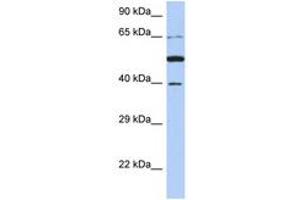 Image no. 1 for anti-Paraneoplastic Antigen MA3 (PNMA3) (AA 71-120) antibody (ABIN6743786)