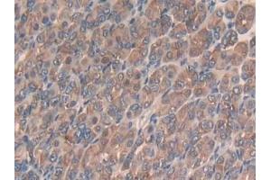 Detection of Slit3 in Mouse Stomach Tissue using Polyclonal Antibody to Slit Homolog 3 (Slit3)