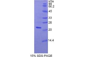 SDS-PAGE analysis of Rat Fibulin 5 Protein. (Fibulin 5 Protein (FBLN5))